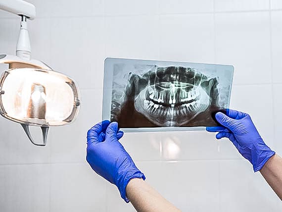 dentist holding up x-ray of teeth to light