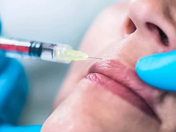 patient being administered a syringe in the lips