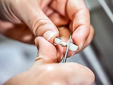 dentist using tool to fix a tooth bridge