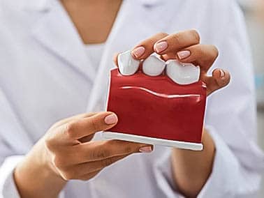 dentist explaining gum lift procedure with plastic model