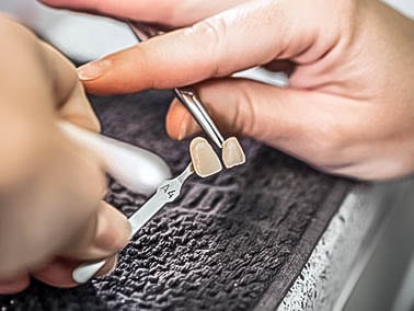 dentist prepping veneers