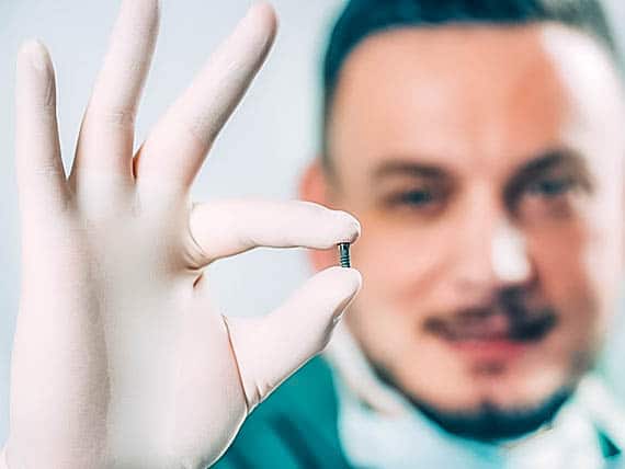 dentist holding up a screw for a dental implant