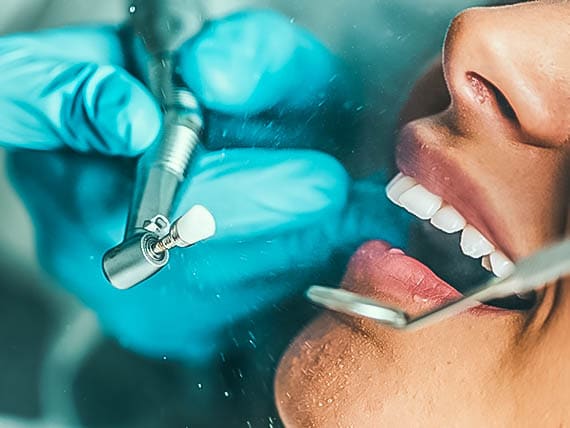 up close of patient receiving a dental cleaning